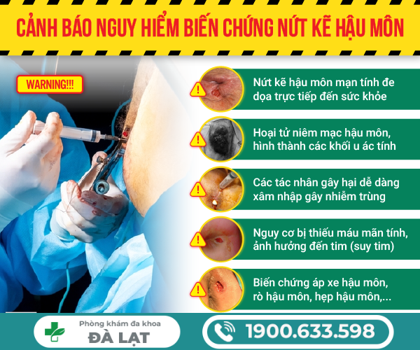 Hình ảnh minh họa
